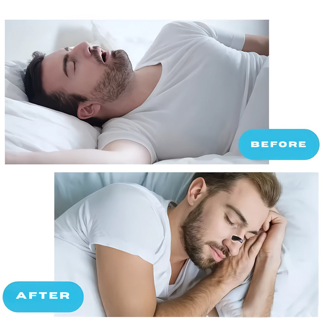 Breatho™ Nasal Dilator
