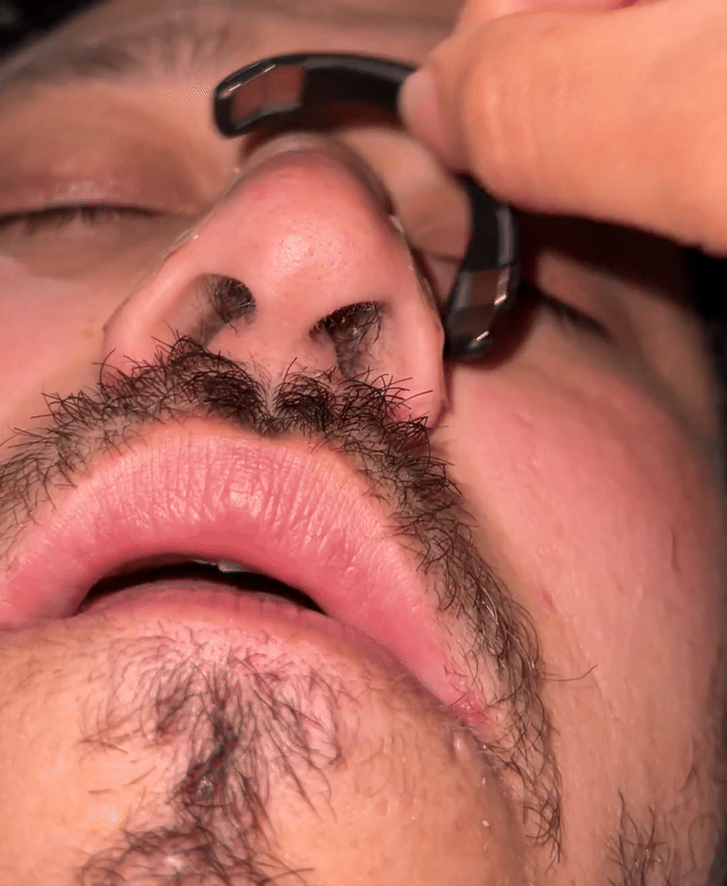 Breatho™ Nasal Dilator
