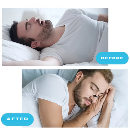 Breatho™ Nasal Dilator